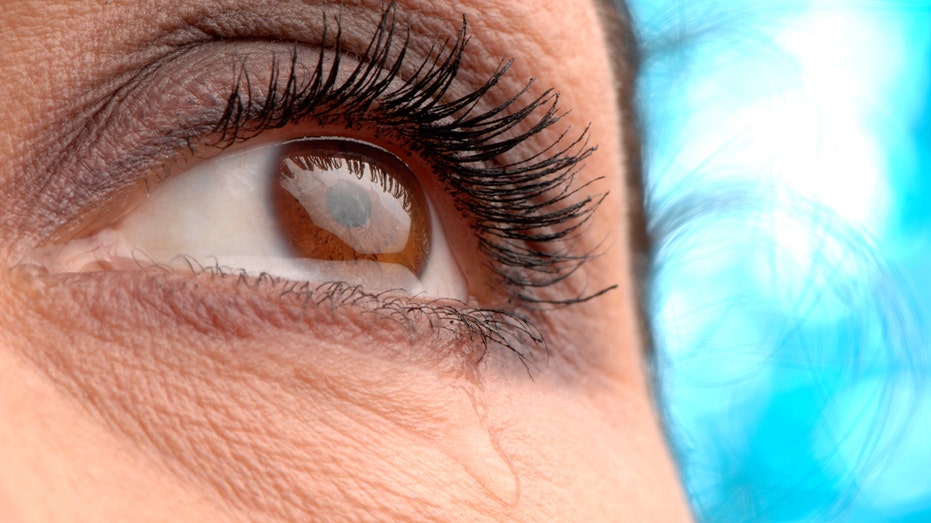 All eyes are on glaucoma, the ‘silent thief of sight’ — and the truth behind 7 myths