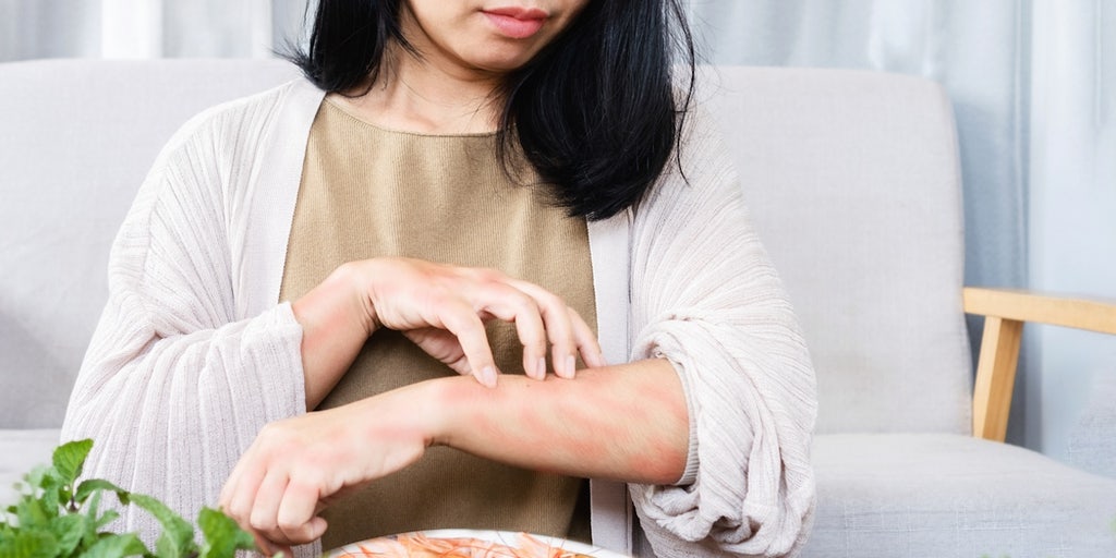 FDA approves allergy drug to lessen severity of reactions to peanuts, dairy, other foods - Vimarsana News