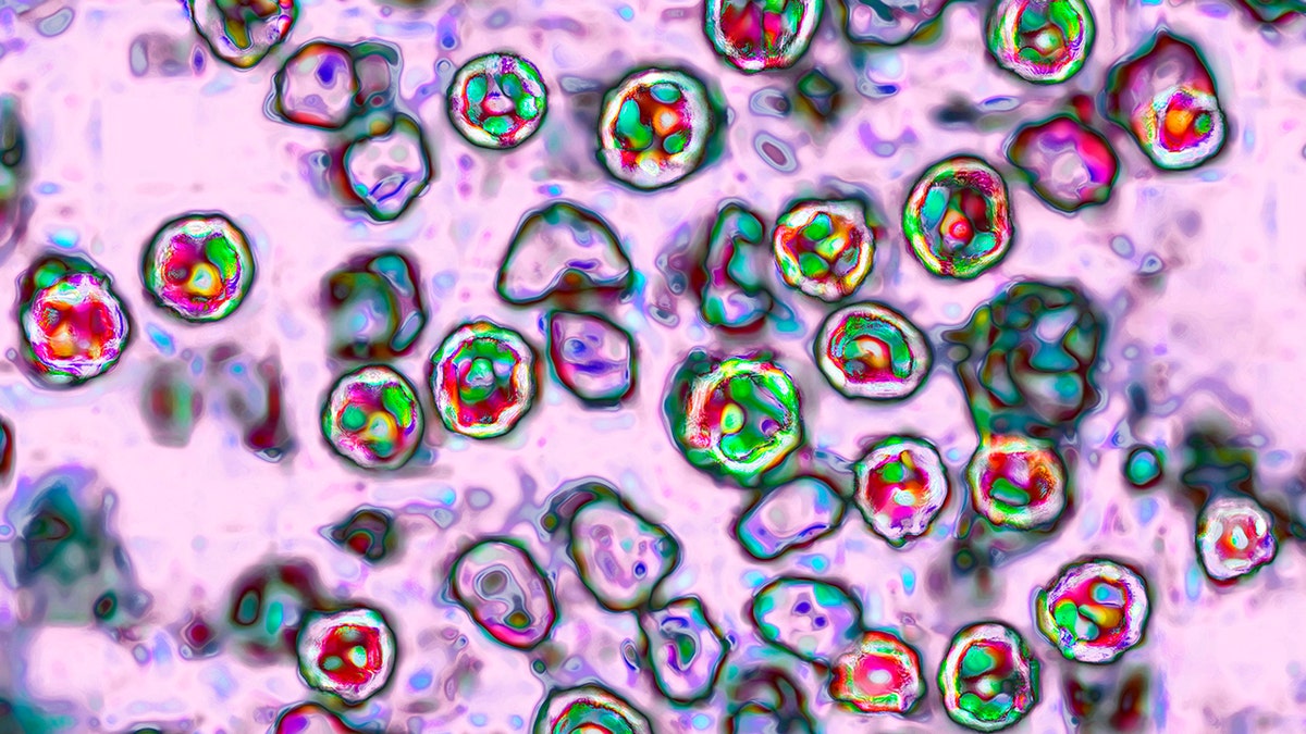 Measles cells