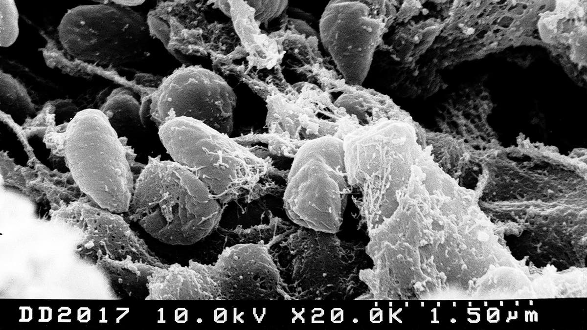 Yersinia pestis 