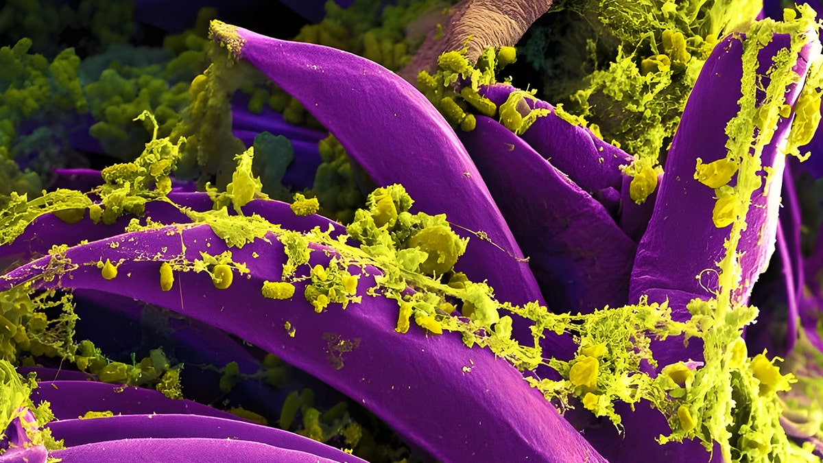 Yersinia pestis related to plague