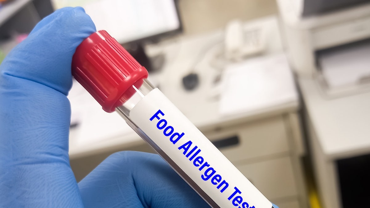 Food allergen test