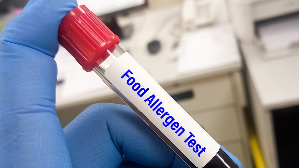 Food allergen test