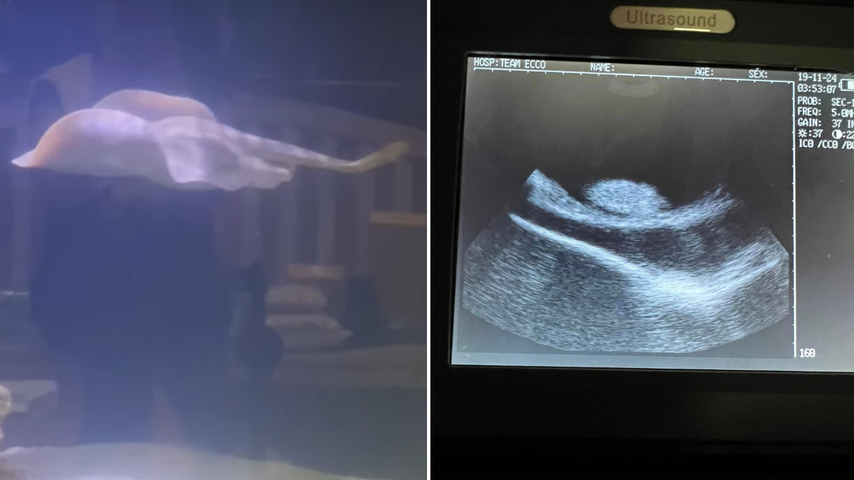 Split image of ultrasound and stingray swimming