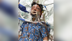 Las Vegas boy, 11, lost his face after he was struck by truck while cycling to school: mother