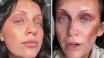 Woman goes viral on TikTok for ‘lazy girl’ makeup trend as dermatologists share beauty hack cautions