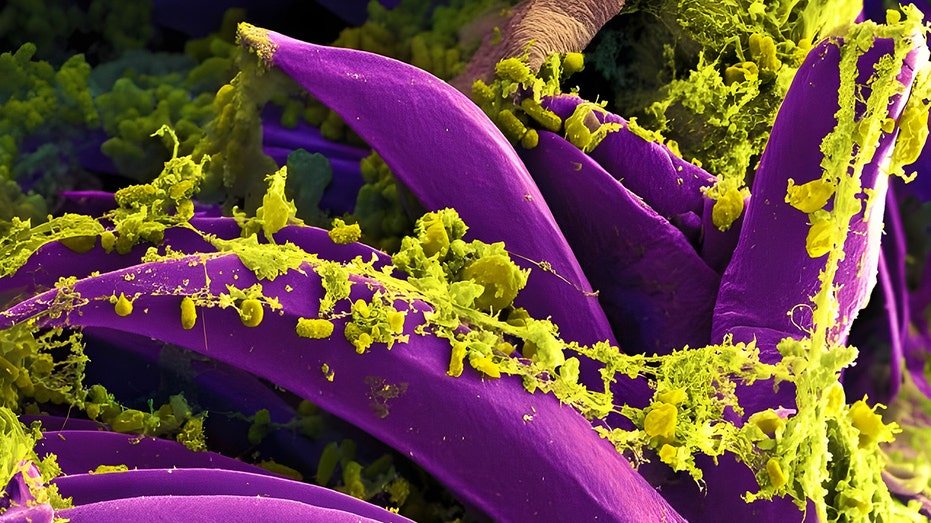 Oregon health officials confirm first human bubonic plague case since 2015