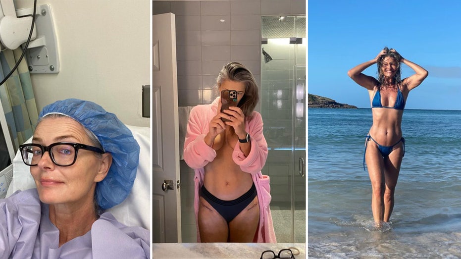 Paulina Porizkova bares deep surgery scars in racy snap after being hospitalized for double hip replacement