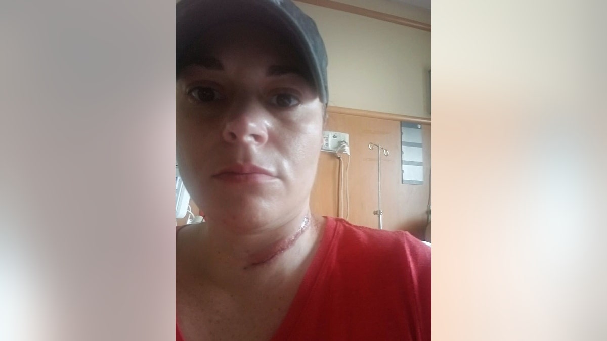 Jennifer Walter pictured with a scar on her neck