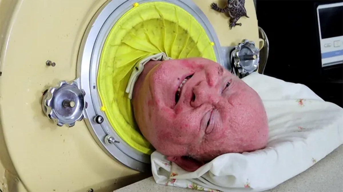 Paul Alexander smiles while lying in his iron lung chamber