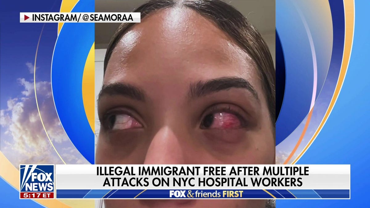 NYC nurse attacked
