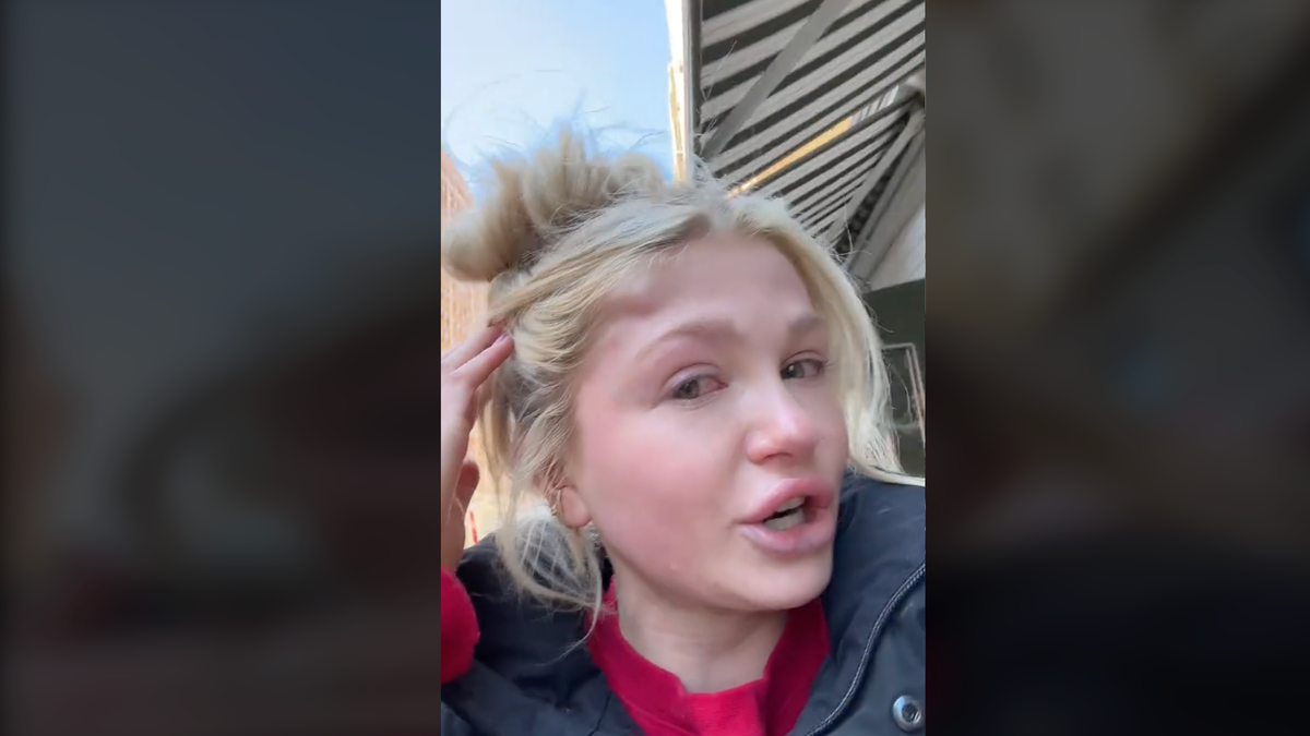 Girl with golf-sized bump on her head in TikTok video.