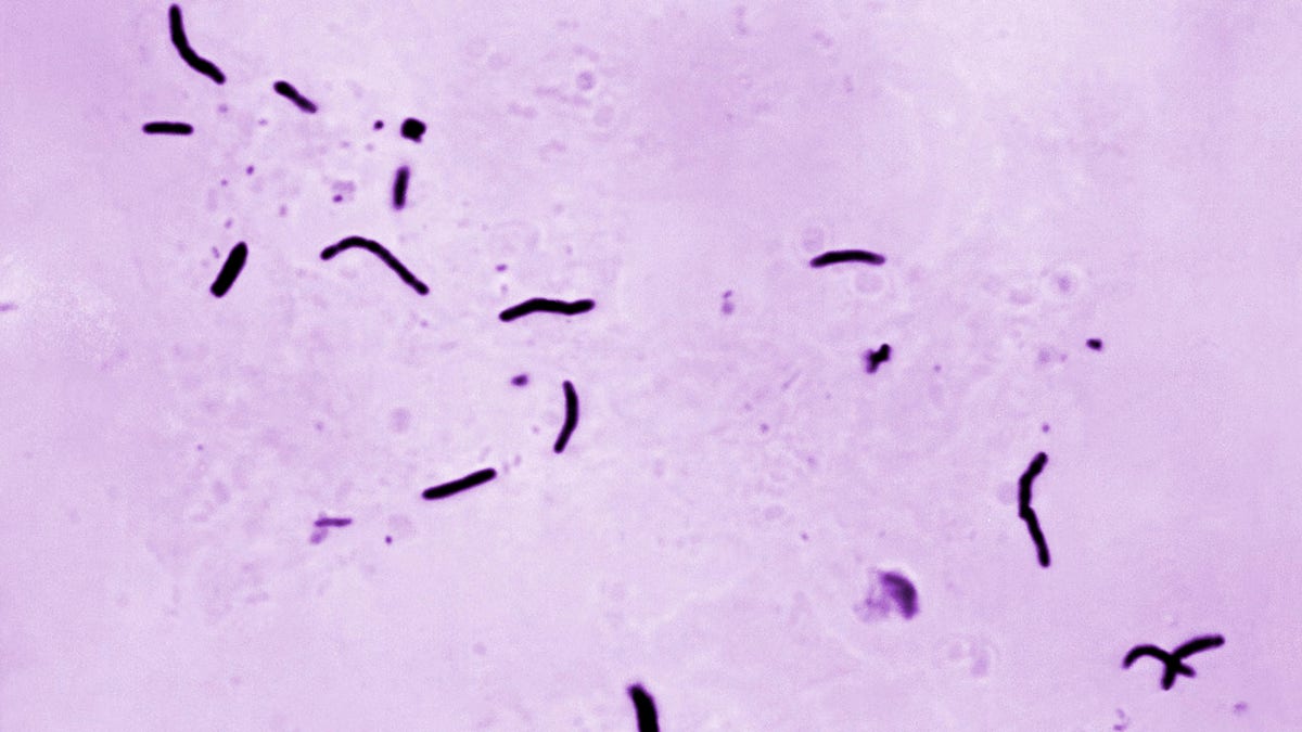 Tuberculosis bacteria in microscope