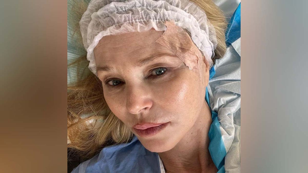 Christie Brinkley after having skin cancer removed