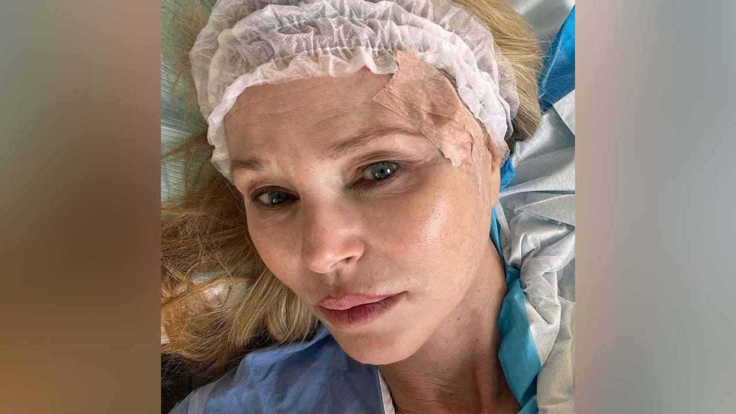 Christie Brinkley's Cancer Scare: A Wake-Up Call to Stay Sun-Wise