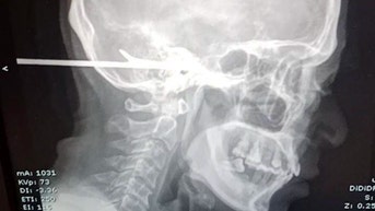 Fisherman's argument with friend over who made the bigger catch takes violent turn