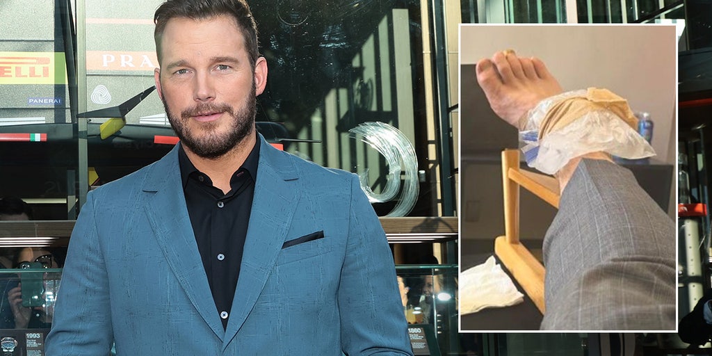 Chris Pratt suffers injury on movie set while doing his own stunts - Vimarsana News
