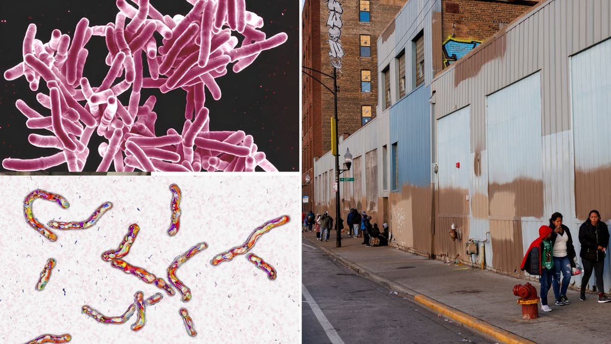 Tuberculosis under a microscope and a Chicago migrant shelter