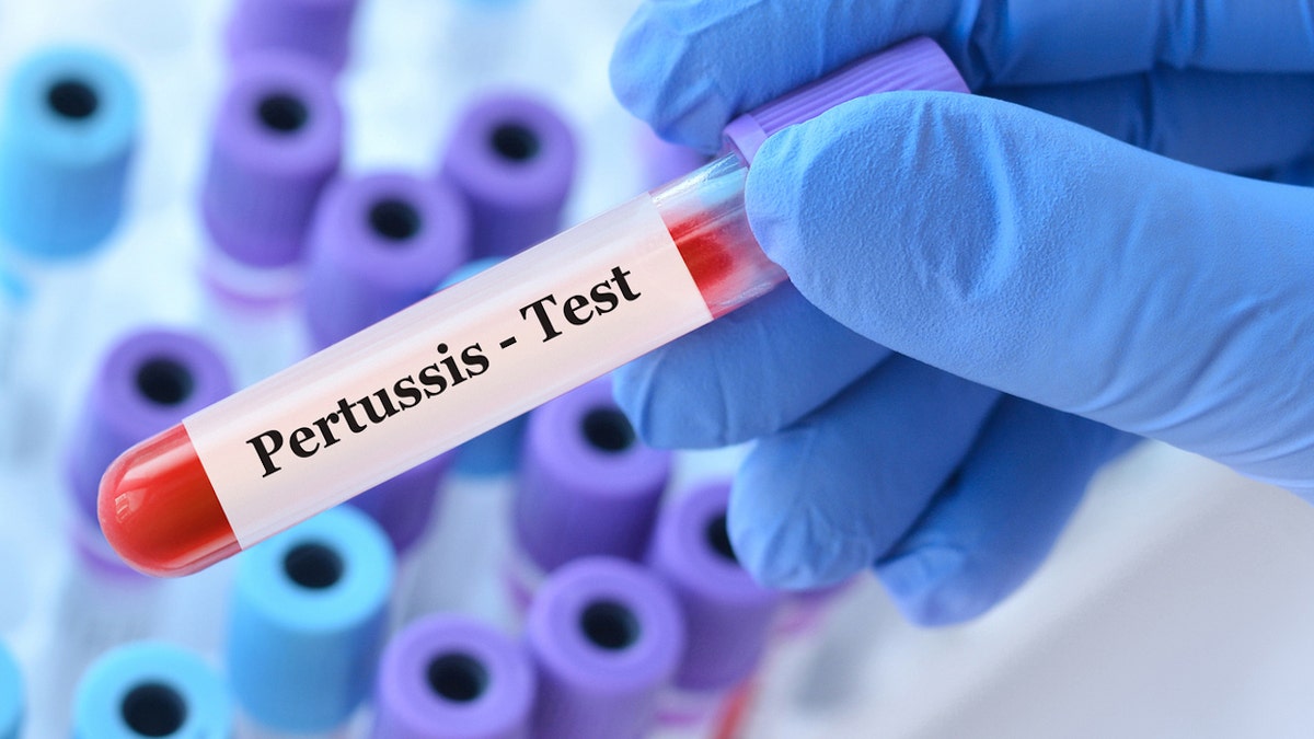 Pertussis test