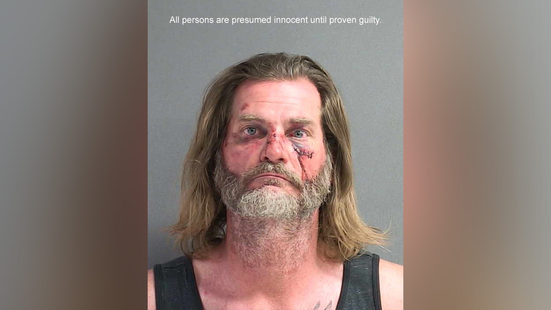 A mugshot of Andrew Burnett