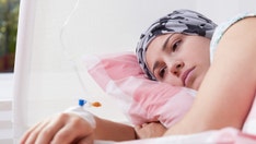 These 17 cancer types are more common in Gen X and millennials, as study notes 'alarming trend'