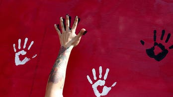 Rare gene variant believed to play a role in understanding why people are left-hand dominant
