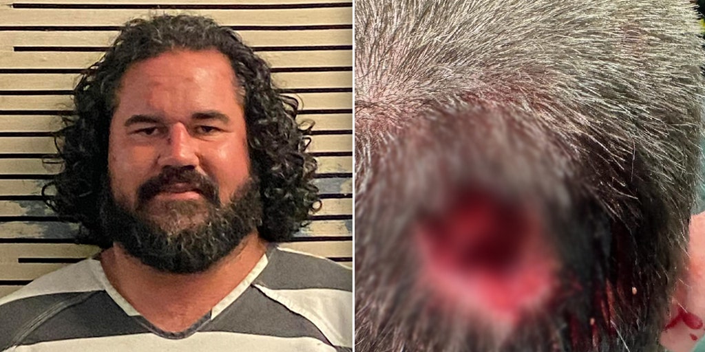 Florida man bit chunk out of deputy's head during assault at music festival: sheriff's office