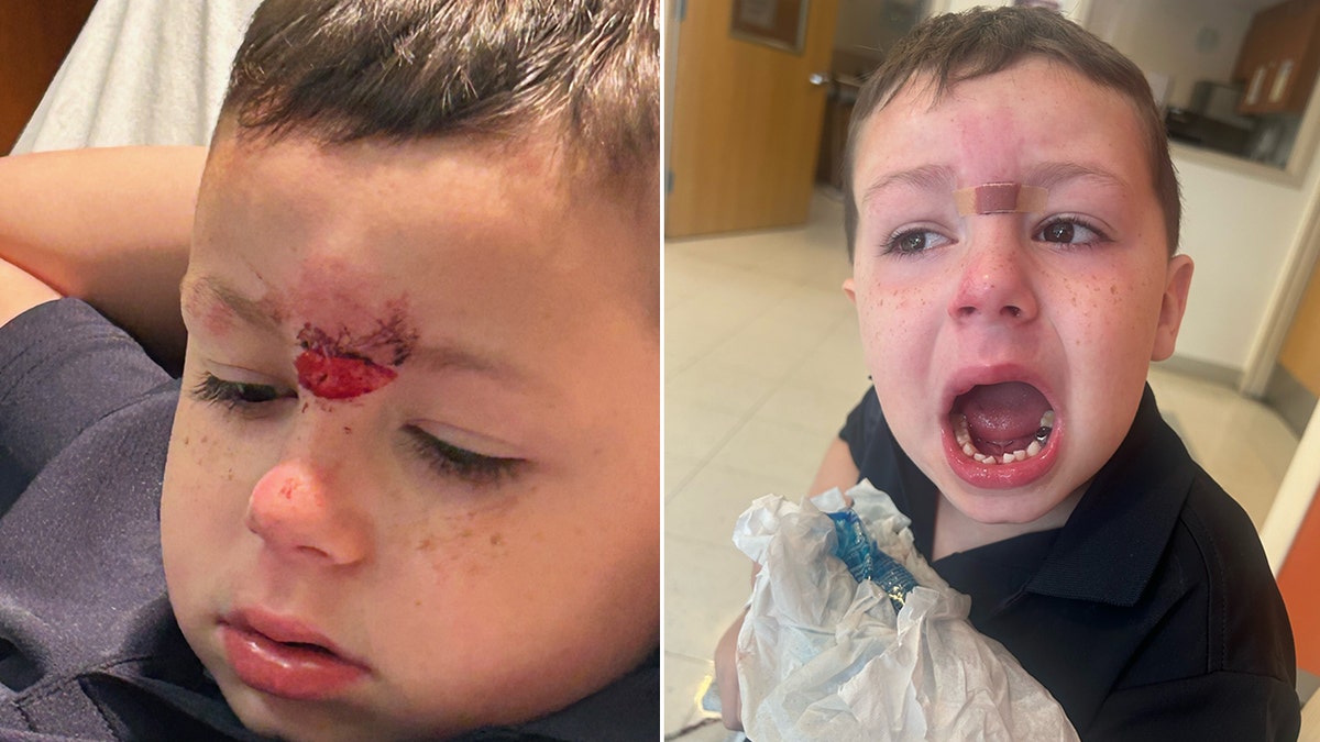 Grayson Callahan's injuries