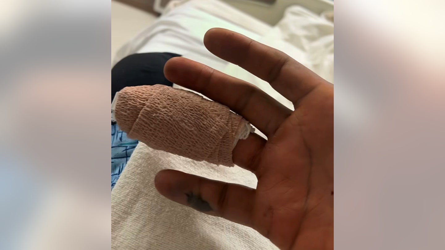 Paul Pierce Suffers Gruesome Finger Injury, Undergoes Surgery