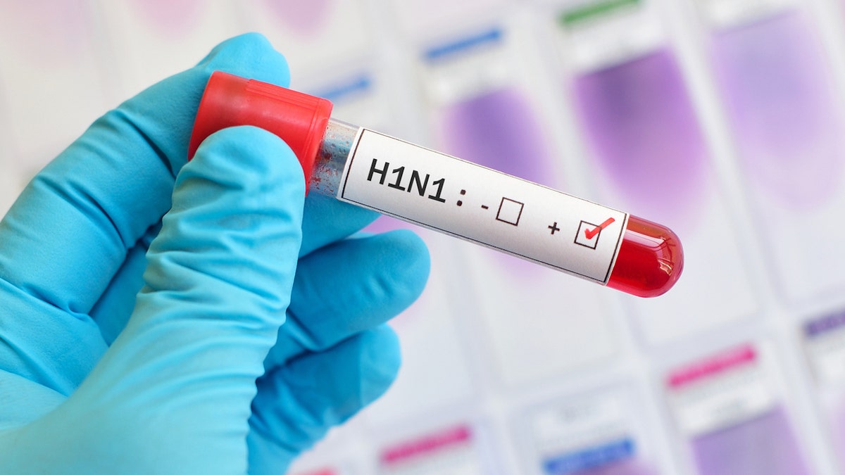 H1N1 lab test