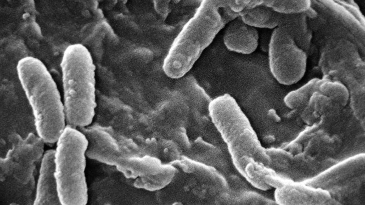 Bakteri Pseudomonas aeruginosa