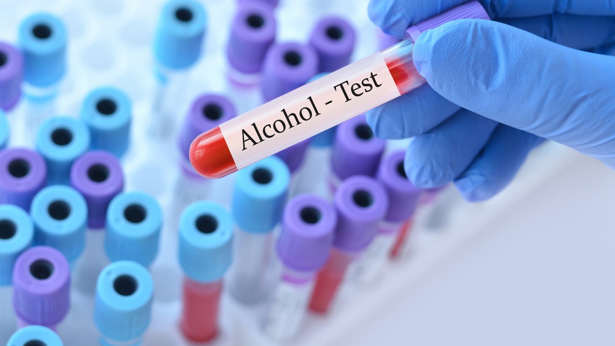 Blood alcohol test
