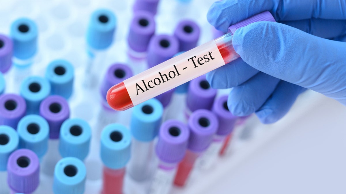 Blood alcohol test