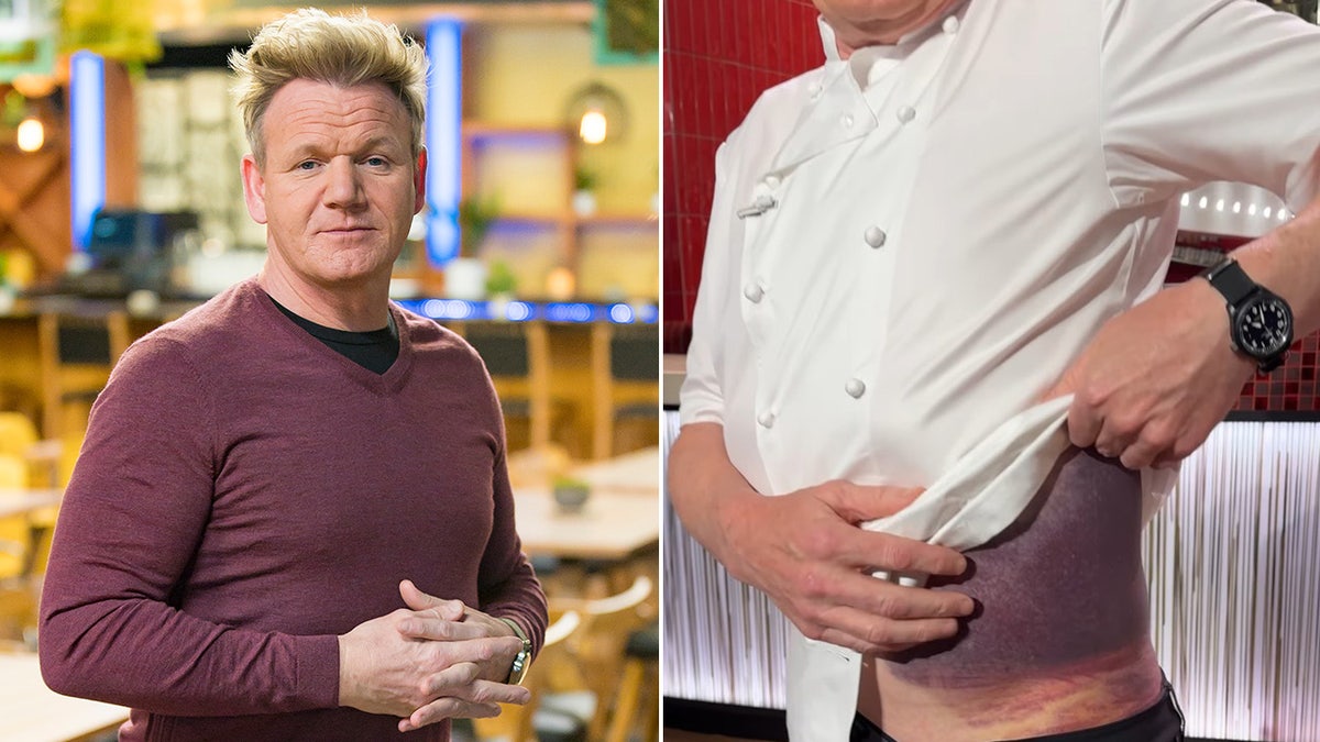 A split image of Gordon Ramsay and his injury