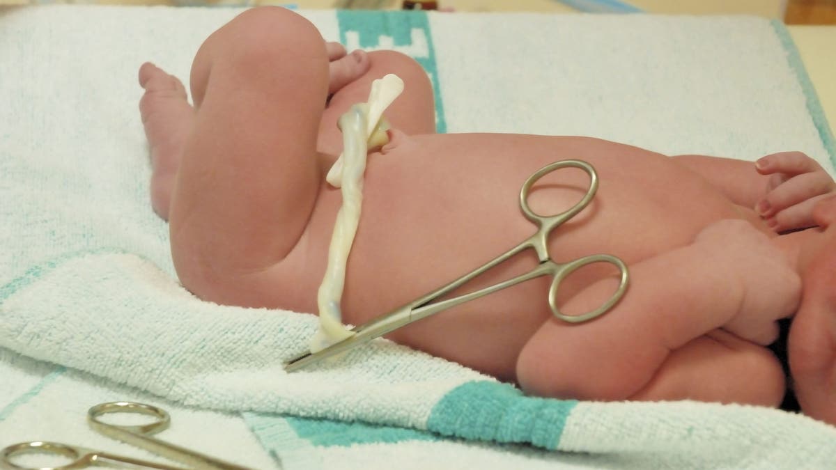 Baby with umbilical cord still attached, ready to be cut