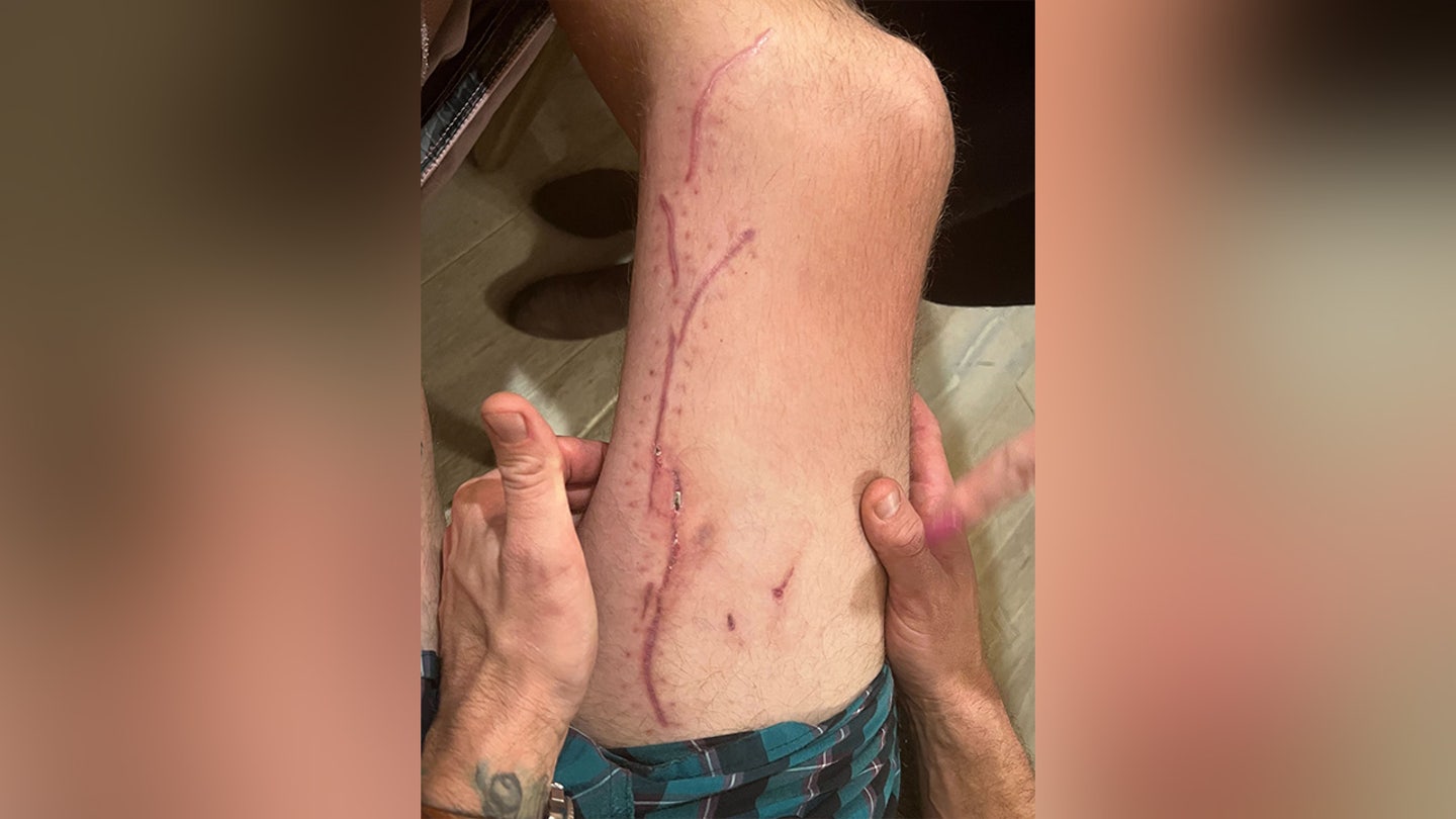 California Shark Attack Survivor Shares Dramatic Encounter and Advice for Surfers