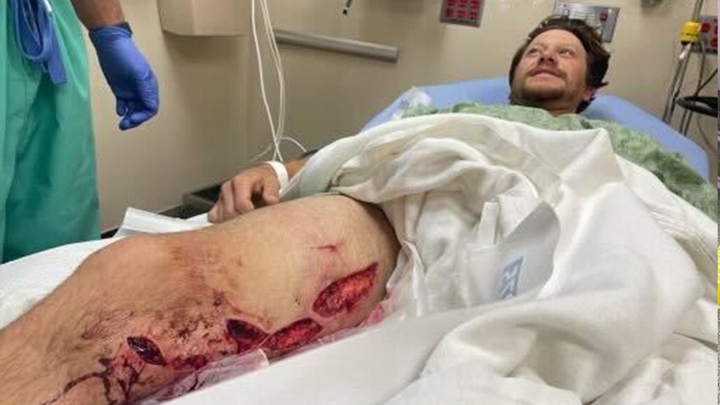 California Shark Attack Survivor Shares Dramatic Encounter and Advice for Surfers