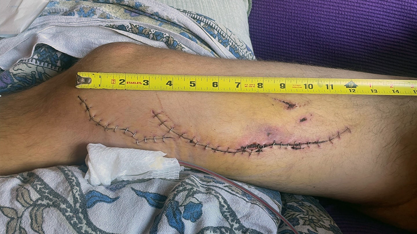 California Surfer Relives Terrifying Great White Shark Attack, Urges Caution