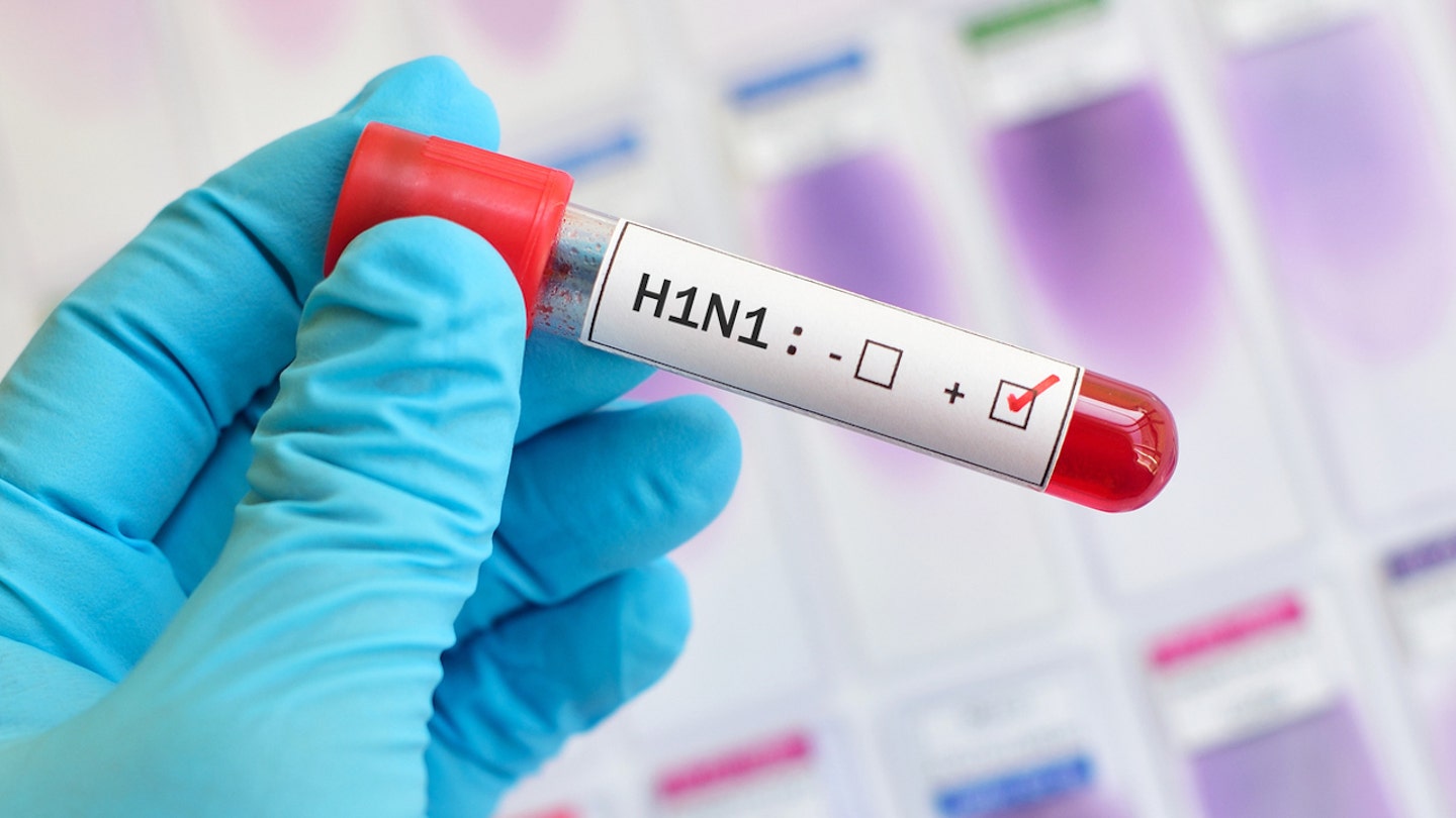 H1N1 lab test