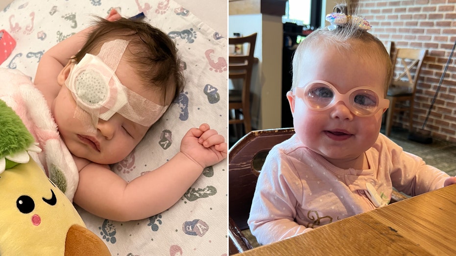 Nebraska baby born with cataracts has 3 eye surgeries to save her sight: ‘I just kept praying’