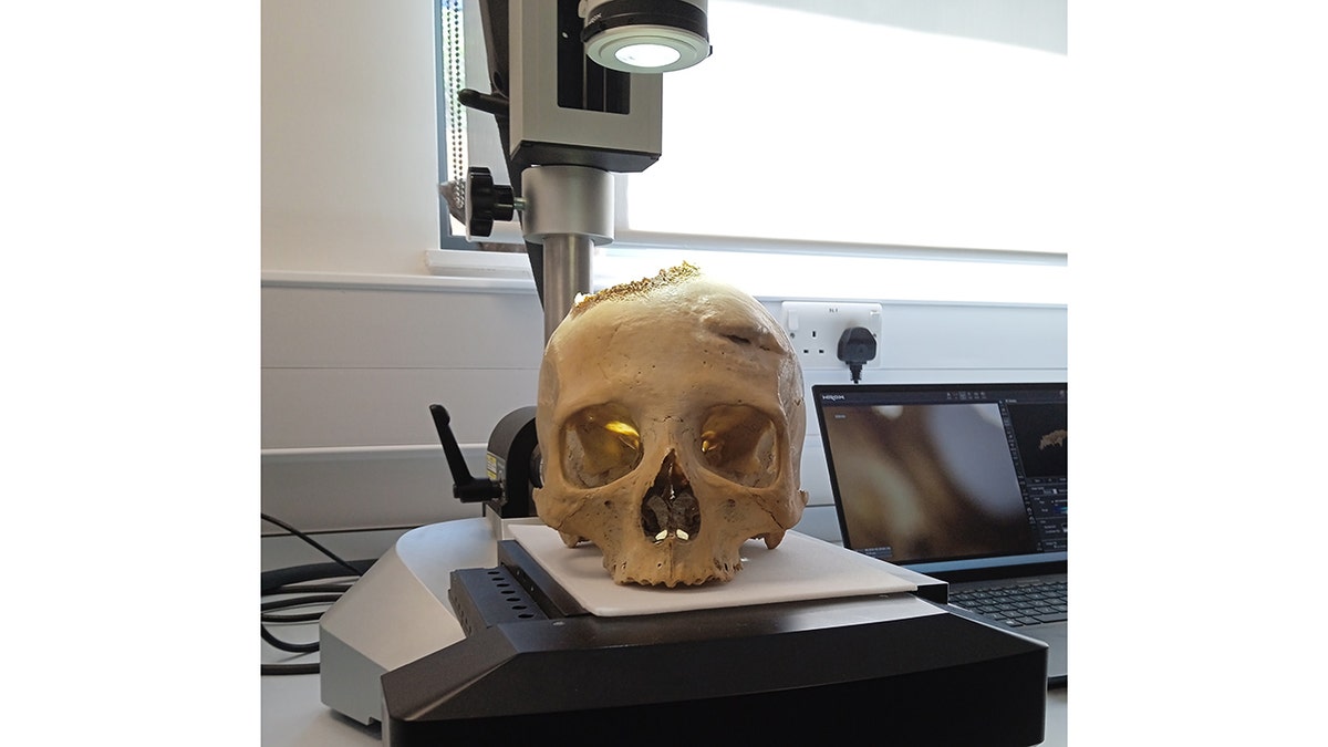 Skull E270 under the microscope.