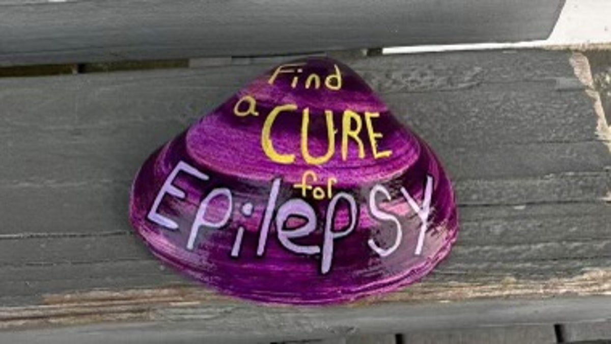 Concha de epilepsia