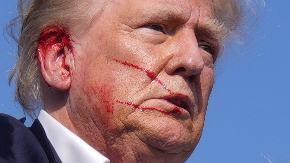 closeup shot of Trump with injured ear and bloodied face