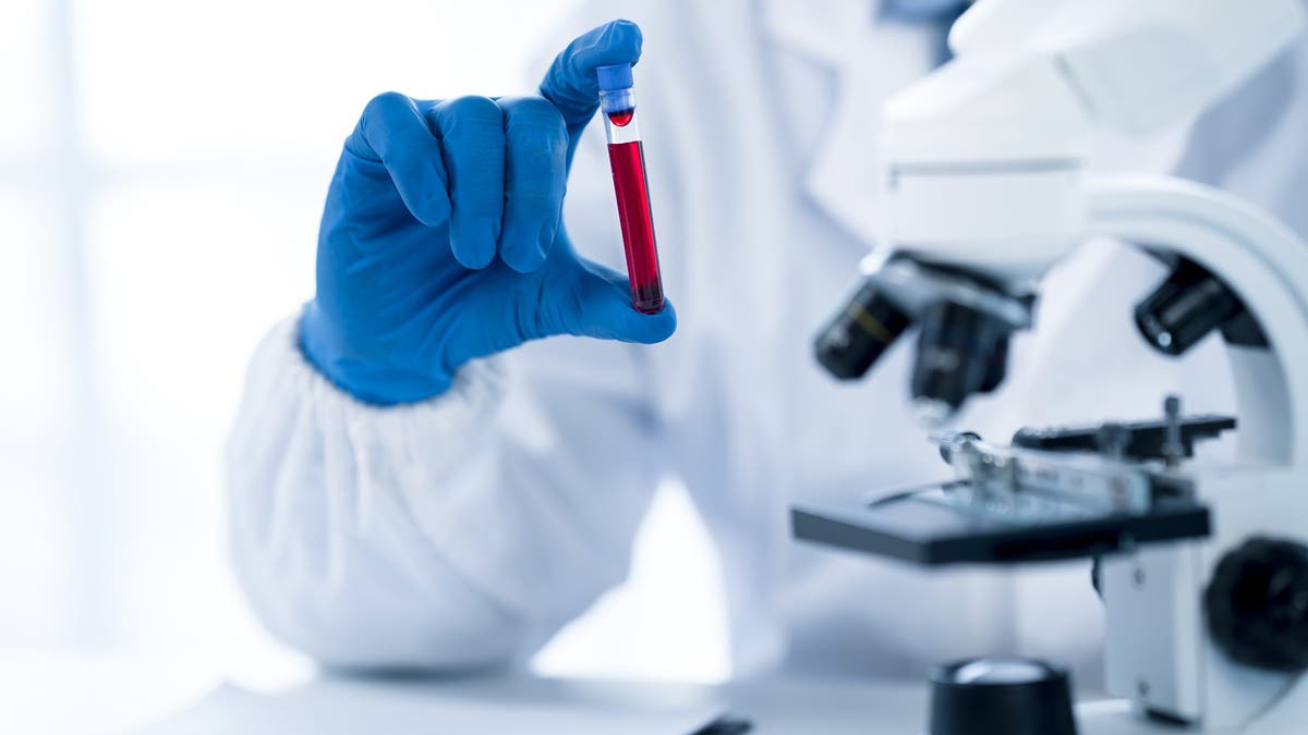 Colon cancer blood screening test approved by FDA: ‘Early detection is ...