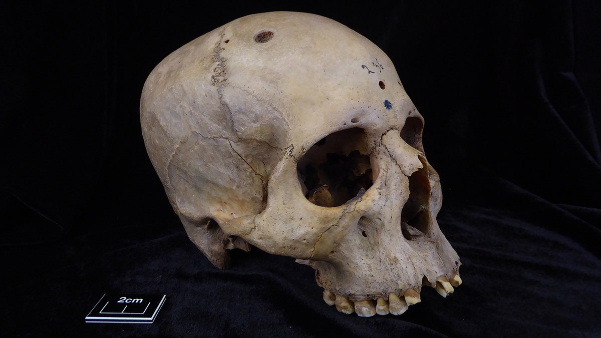 A picture of skull 236.