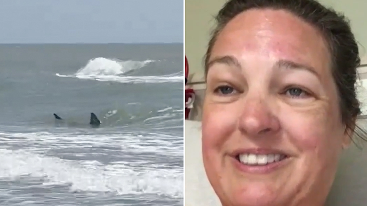 Texas woman bitten by shark