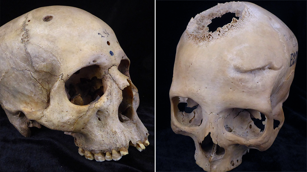 split image of skull 236 and E270