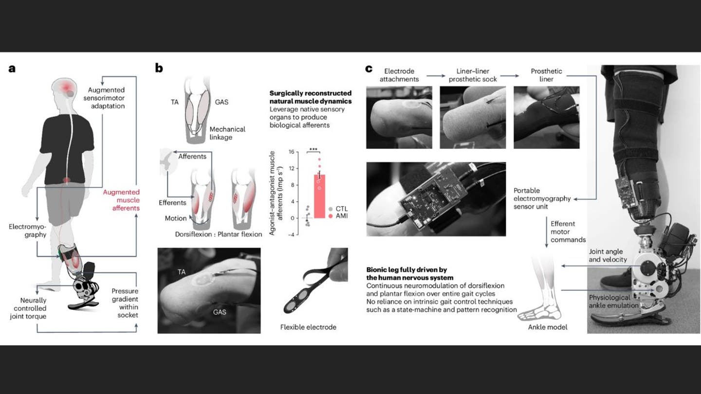 2 Breakthrough prosthetic technology enables natural movement through nervous system connection