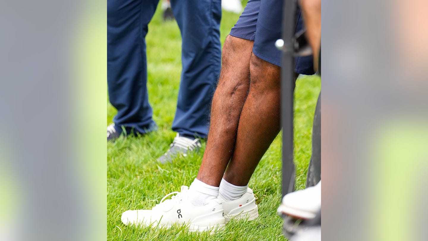 Tiger Woods' Leg Scar Stuns Spectators, Raises Concerns About His Golfing Future