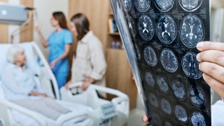 AI wearable helps stroke survivors speak again